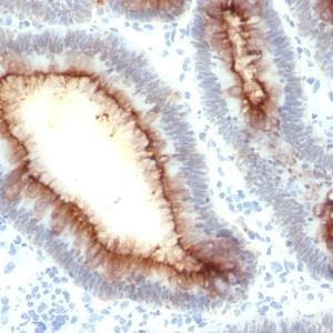 Carcinoembryonic Antigen (CEA) / CD66; Clone SPM330 (Concentrate)